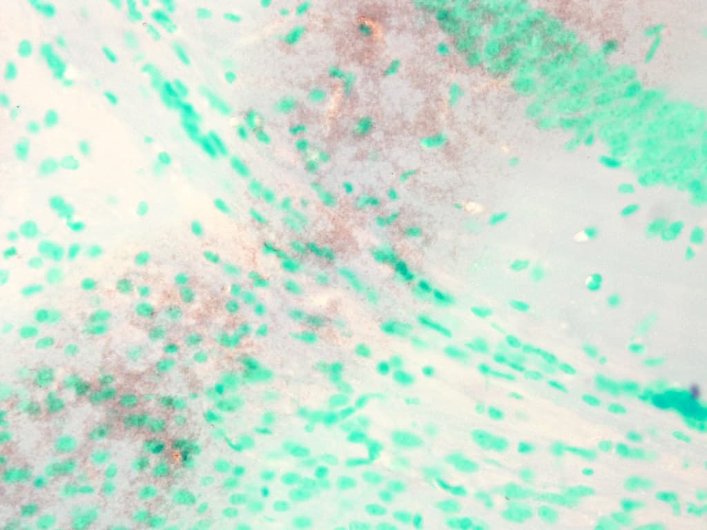 KCNQ1 / KVLQT1 Antibody (aa2-101, clone N37A/10)