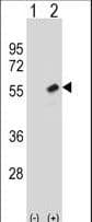 Polyclonal Rabbit anti-Human RBBP7 / RbAp46 Antibody (aa191-219, WB)