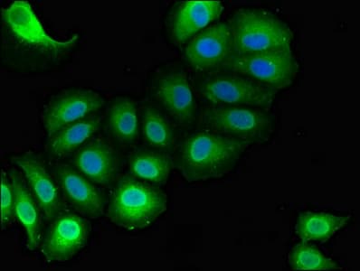 Polyclonal Rabbit anti-Human RAI1 Antibody (IHC, IF, WB)