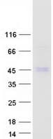 Human MACROD2 Protein (Recombinant Myc-DDK (Flag))