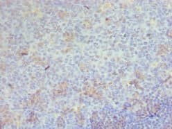 Polyclonal Rabbit anti-Human CD68 Antibody (aa22-319, IHC)