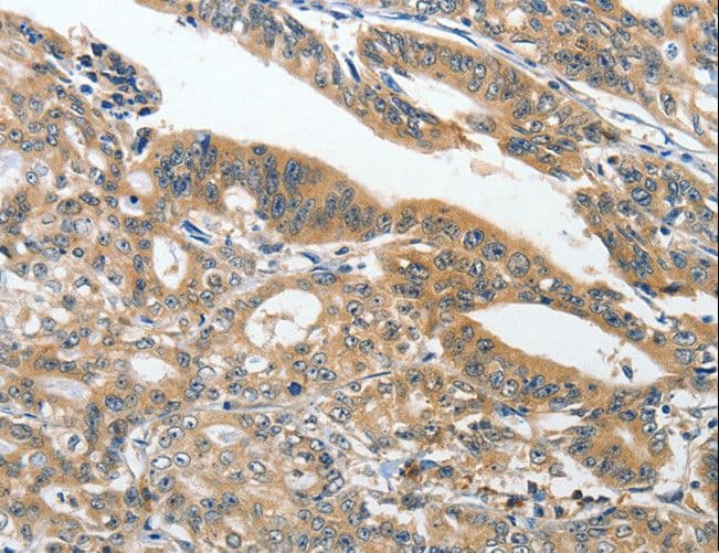Polyclonal Rabbit anti-Human ANKZF1 Antibody (IHC)