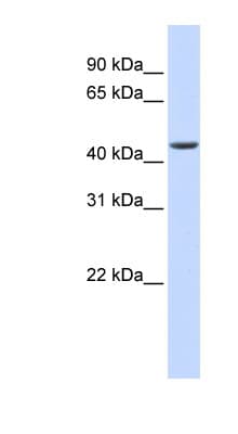 Polyclonal Rabbit anti-Human ELAC1 Antibody (aa180-229, WB)