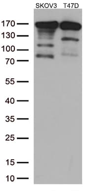 ERBB2 / HER2 Antibody (aa676-1255, clone UMAB34)
