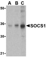 IHC-plus™ SOCS1 Antibody