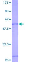 Human ANT2 / SLC25A5 Protein (Recombinant GST)