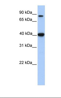 ACAT1 Antibody (aa218-267)