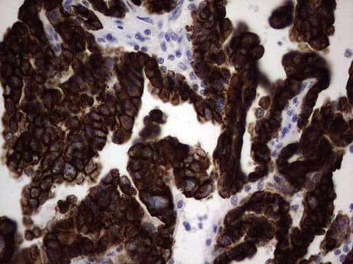 Monoclonal Mouse anti-Human KRT19 / CK19 / Cytokeratin 19 Antibody (clone OTI6E8, aa240-390, IHC)