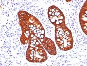 KRT19 / CK19 / Cytokeratin 19 Antibody (clone A53-B/A2.26 + BA17)
