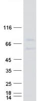 Human PCSK9 Protein (Recombinant Myc-DDK (Flag))