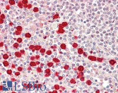 TOM1L1 Antibody (aa276-325)