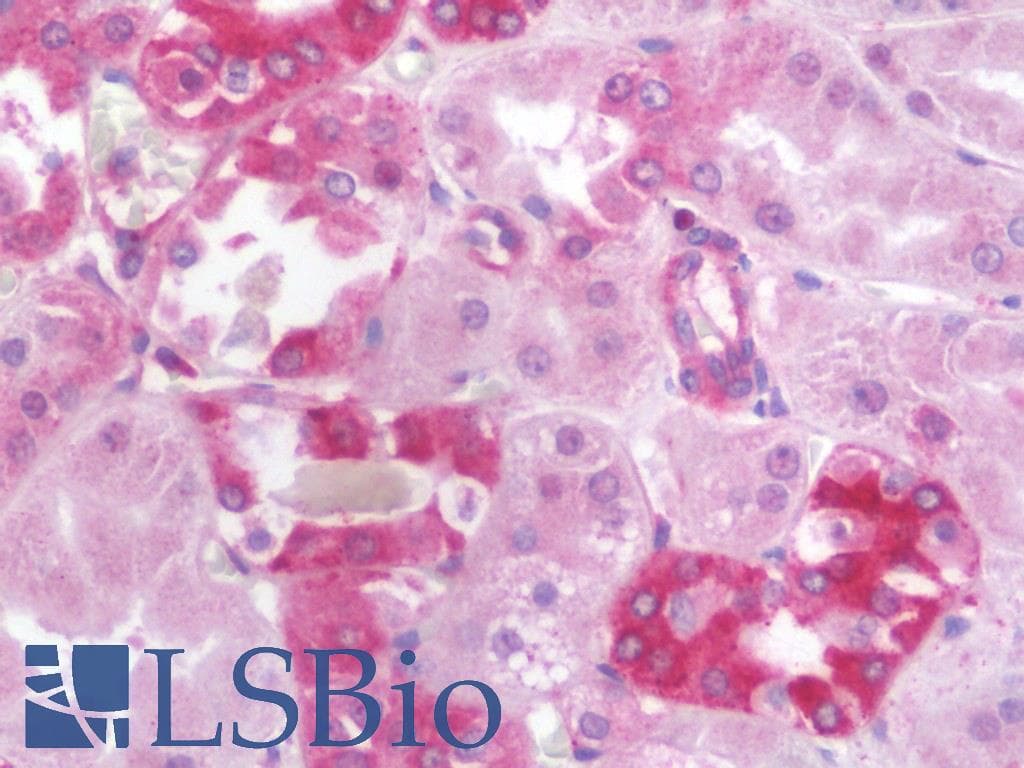 IHC-plus™ Polyclonal Rabbit anti-Human TYK2 Antibody (IHC, WB)