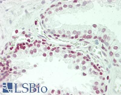 IHC-plus™ DDX47 Antibody (aa405-455)