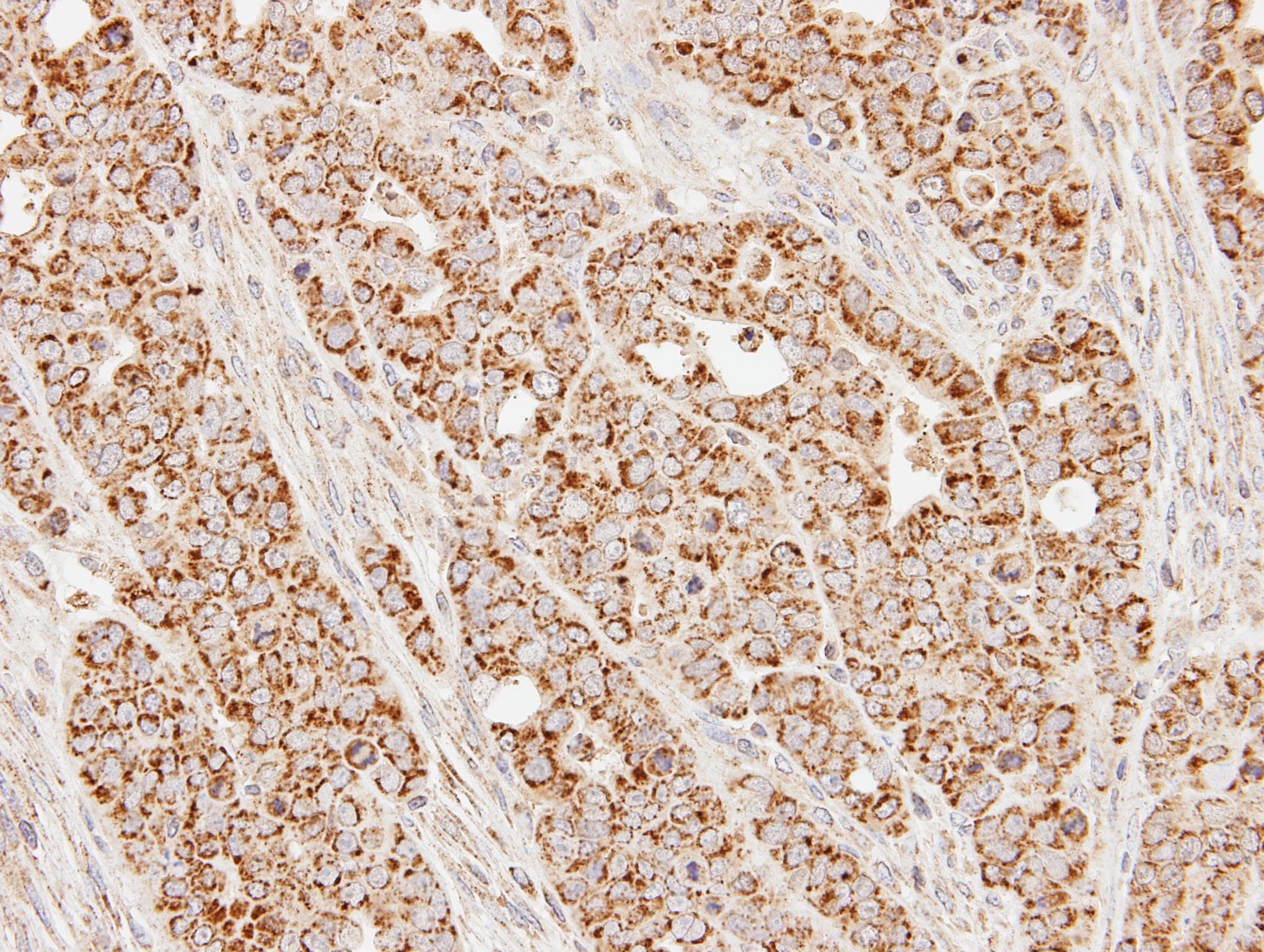 SUCLG1 / GALPHA Antibody (aa1-346)