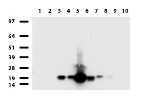 VILIP / VSNL1 Antibody (aa2-191, clone UMAB115, Carrier-free)