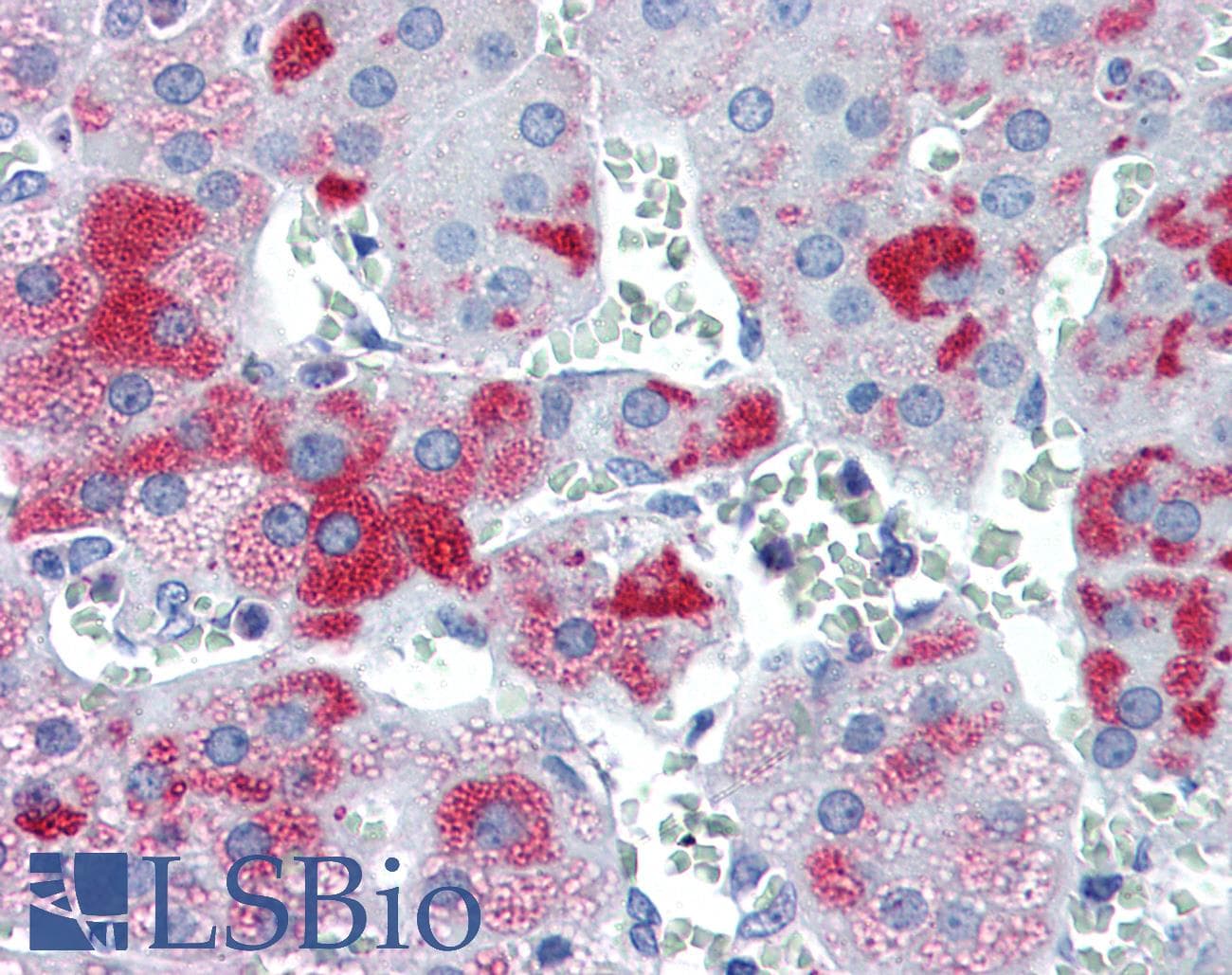 IHC-plus™ Polyclonal Rabbit anti-Human PLIN3 / M6PRBP1 / TIP47 Antibody (IHC, WB)