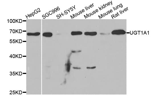 UGT1A / UGT1A1 Antibody