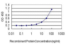 RNMT / HCM Antibody (clone 3H3-1D12)
