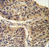 Polyclonal Rabbit anti-Human CCT3 Antibody (aa509-536, IHC, WB)