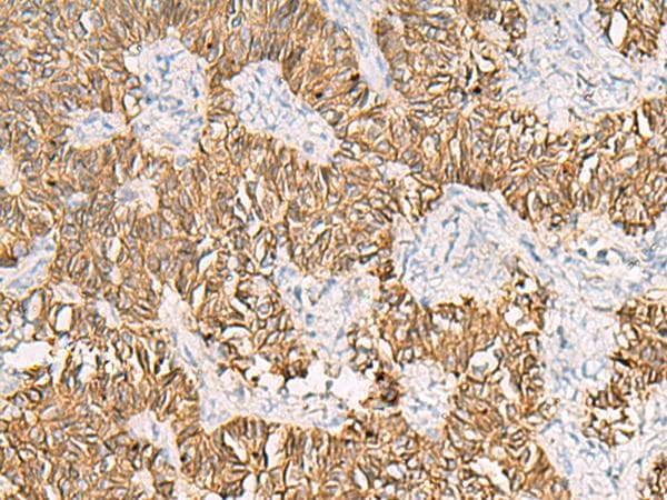 SLC16A1 / MCT1 Antibody