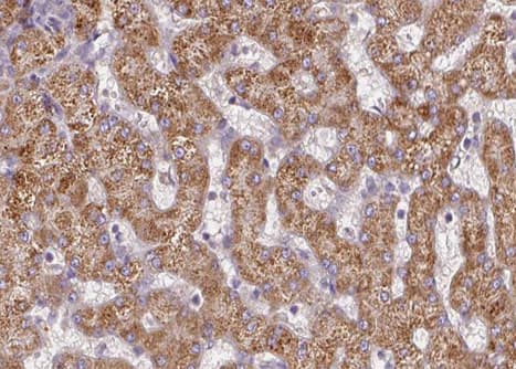 Polyclonal Rabbit anti-Human CPT2 Antibody (IHC, IF, WB)