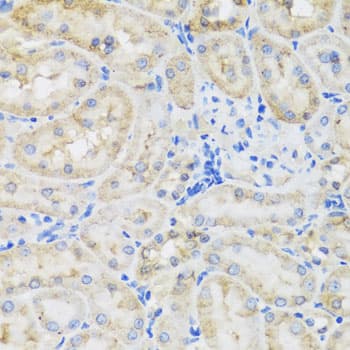 Polyclonal Rabbit anti-Human TIRAP Antibody (IHC, IF, WB)