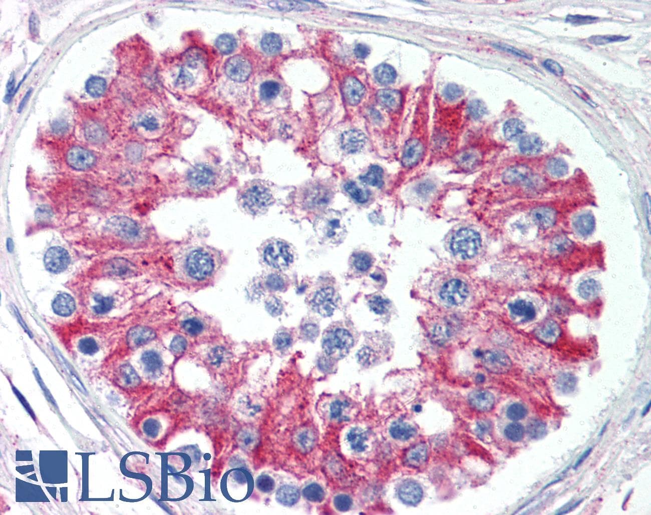 IHC-plus™ SMAD6 Antibody (aa85-99)