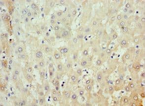 MKS1 Antibody (aa150-300)