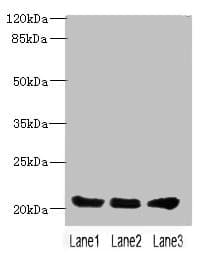 PLLP / Plasmolipin Antibody