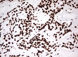 Monoclonal Mouse anti-Human HNRPM / HNRNPM Antibody (clone OTI3F3, aa1-261, IHC, WB)