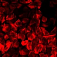 BLMH Antibody