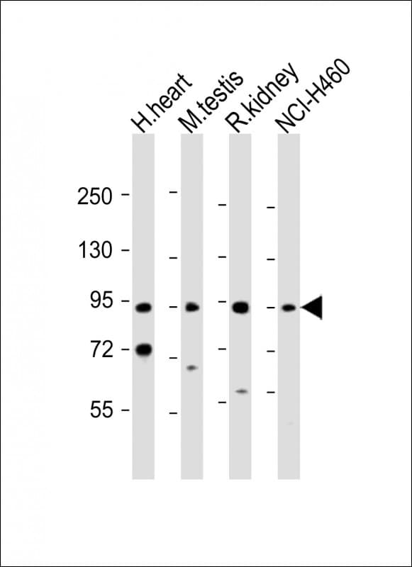 PDE1C Antibody (aa375-409)