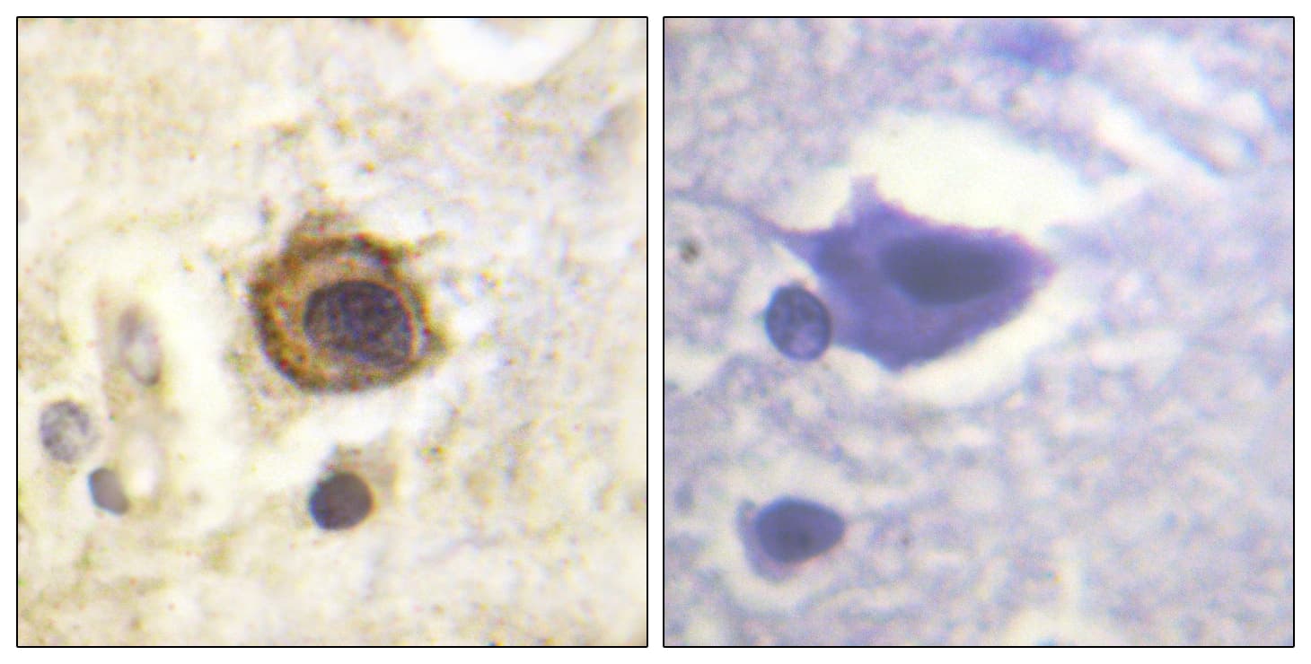 Polyclonal Rabbit anti-Human PDGFRB / PDGFR Beta Antibody (aa991-1040, IHC, IF, WB)