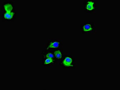 Polyclonal Rabbit anti-Human LIG3 / DNA Ligase III Antibody (IHC, IF)