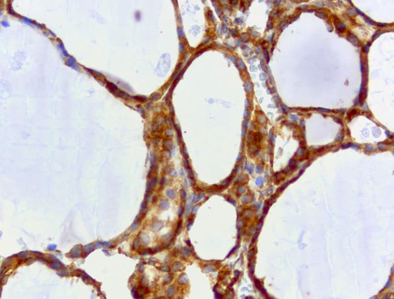 WIBG Antibody (clone UMAB207)