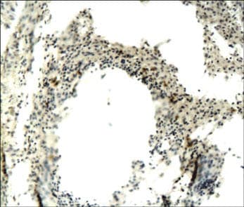 CD68 Antibody
