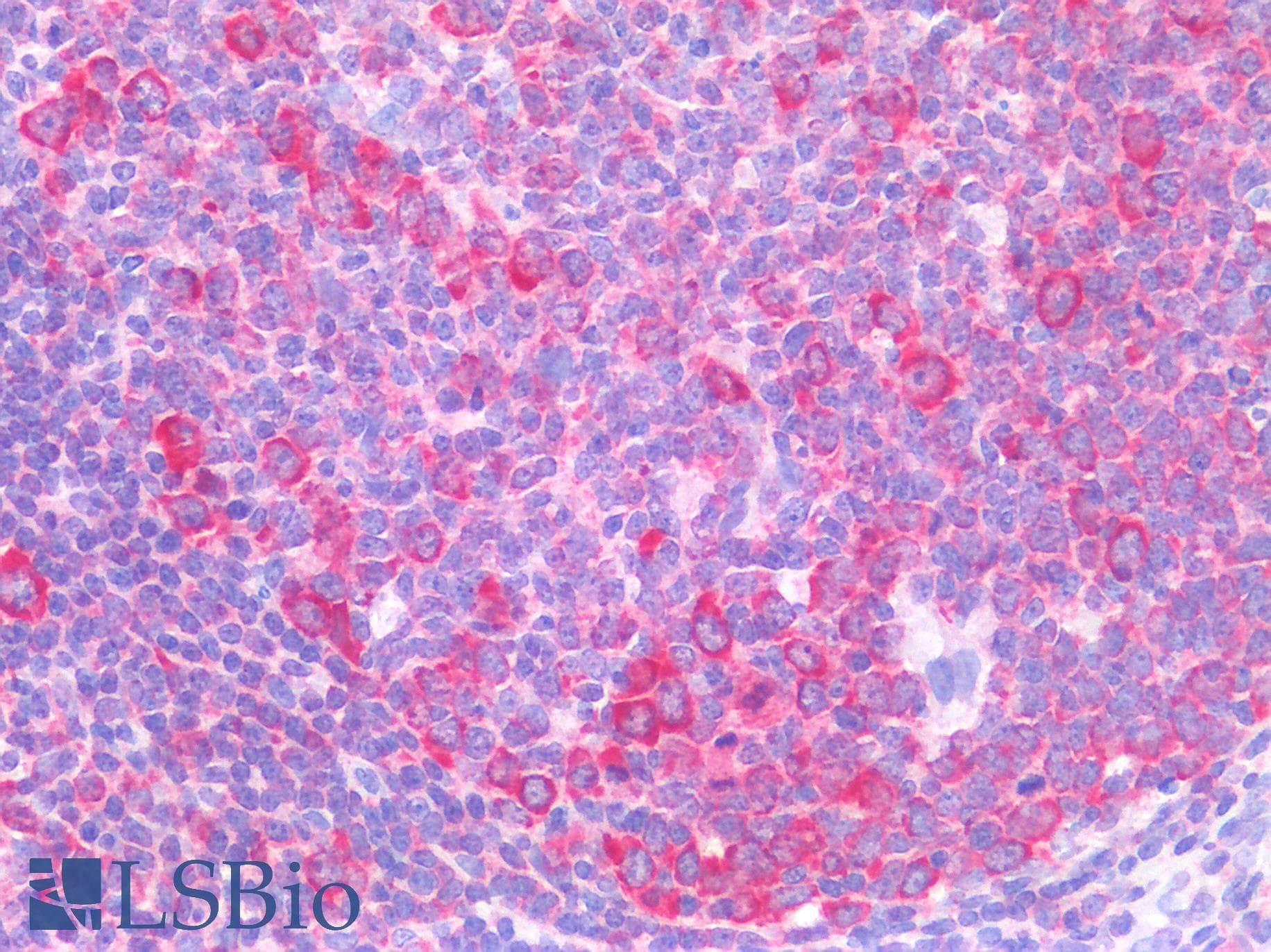 IHC-plus™ Monoclonal Mouse anti-Human Ribosomal protein S27 (metallopanstimulin 1) (RPS27) Antibody (clone 4A12, IHC)