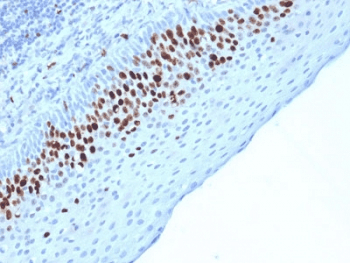 MKI67 / Ki67 Antibody (clone MKI67/2463)