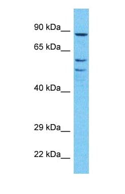 RPE65 Antibody (Internal)