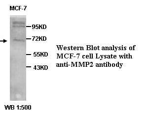 Polyclonal Rabbit anti-Human MMP2 Antibody (IHC, WB)