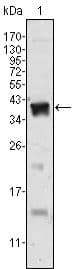 AR / Androgen Receptor Antibody (clone 2H8)