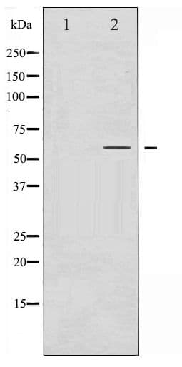 SMAD3 Antibody (phospho-Ser425)