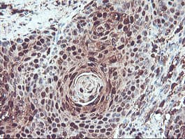 SERPINB1 Antibody (clone OTI4B3)