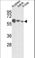 IGFALS / ALS Antibody (aa308-335)