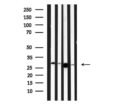MBL2 / Mannose Binding Protein Antibody