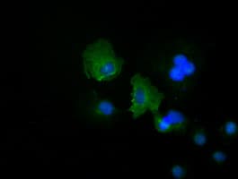 KRT19 / CK19 / Cytokeratin 19 Antibody (clone OTI5D1)