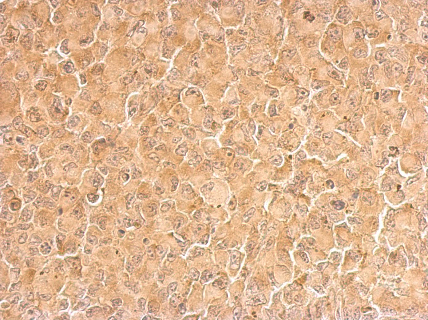 Polyclonal Rabbit anti-Human RPL6 / Ribosomal Protein L6 Antibody (IHC, IF, WB)
