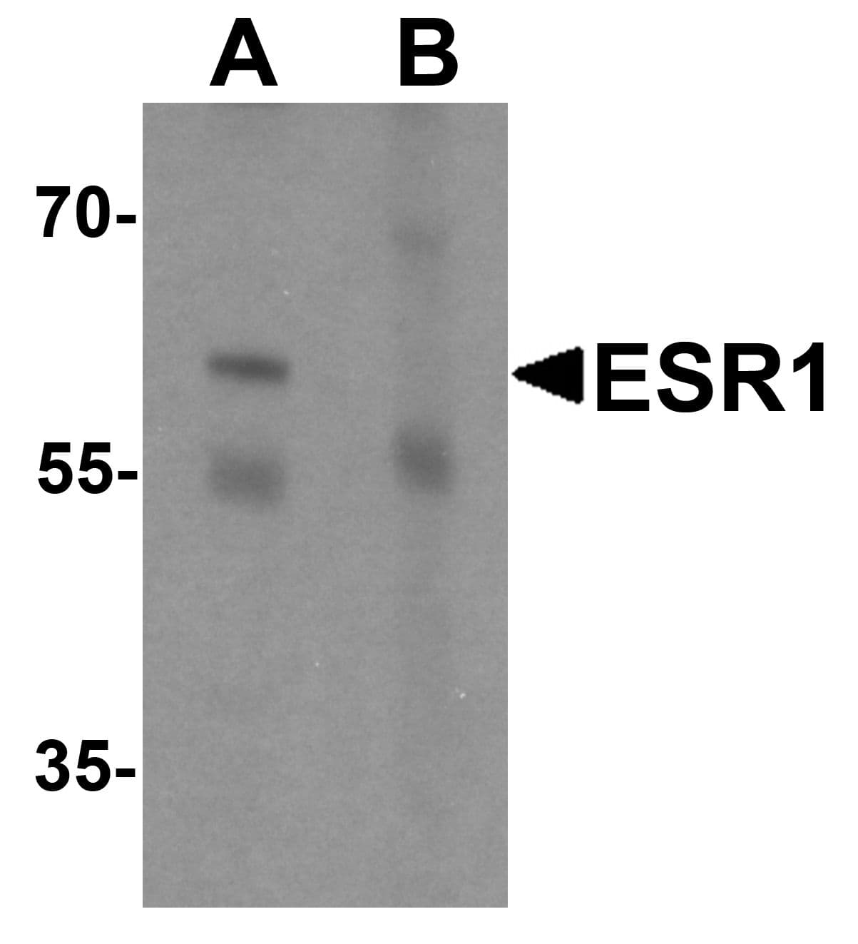 ER Alpha / Estrogen Receptor Antibody
