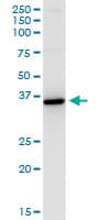 HSD11B1 / HSD11B Antibody (clone 2C10)