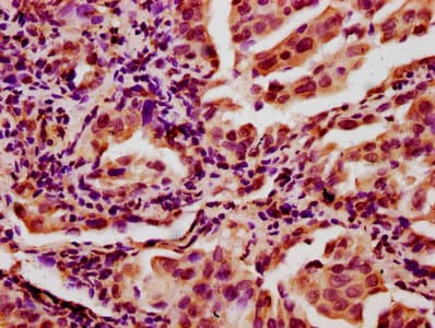 Polyclonal Rabbit anti-Human CHAF1A / CAF1 Antibody (IHC)
